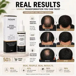 Proskire Hair Growth Serum – Reduces Hair Fall, Boosts Hair Density, Activates Follicles – For Bald Patches, Receding Hairline & Thinning Hair | BUY 1 GET 1 FREE